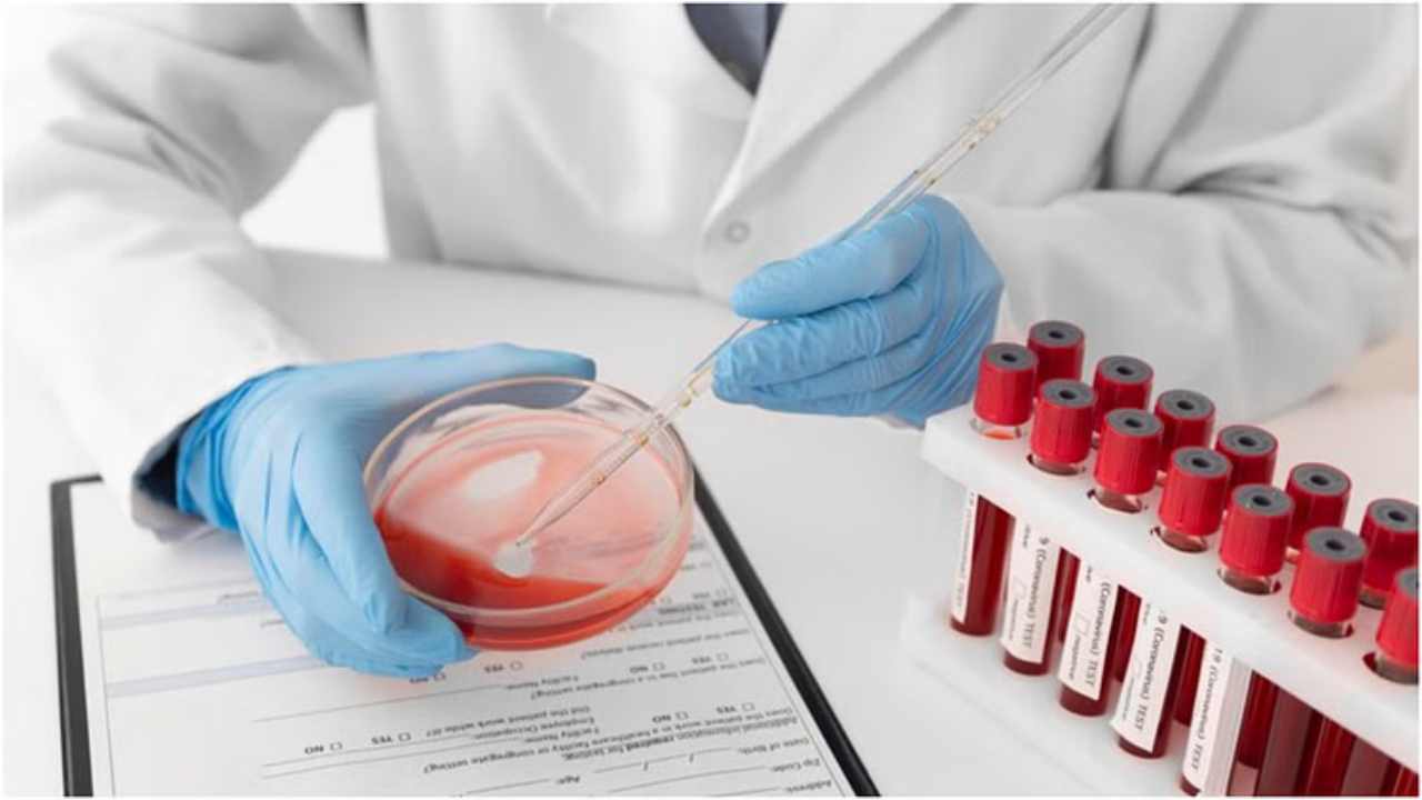 CRIB Blood Group